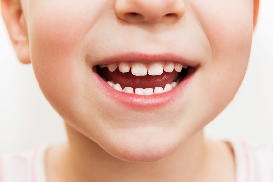 Durerea de dinti la copii - cauze si factori de risc