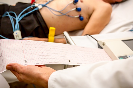 Electrocardiograma (EKG) – cand trebuie efectuata si ce arata