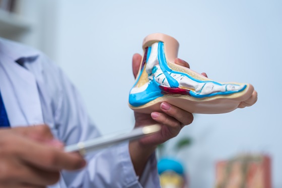 Cum alegeti incaltamintea potrivita pentru diferitele afectiuni ale piciorului?