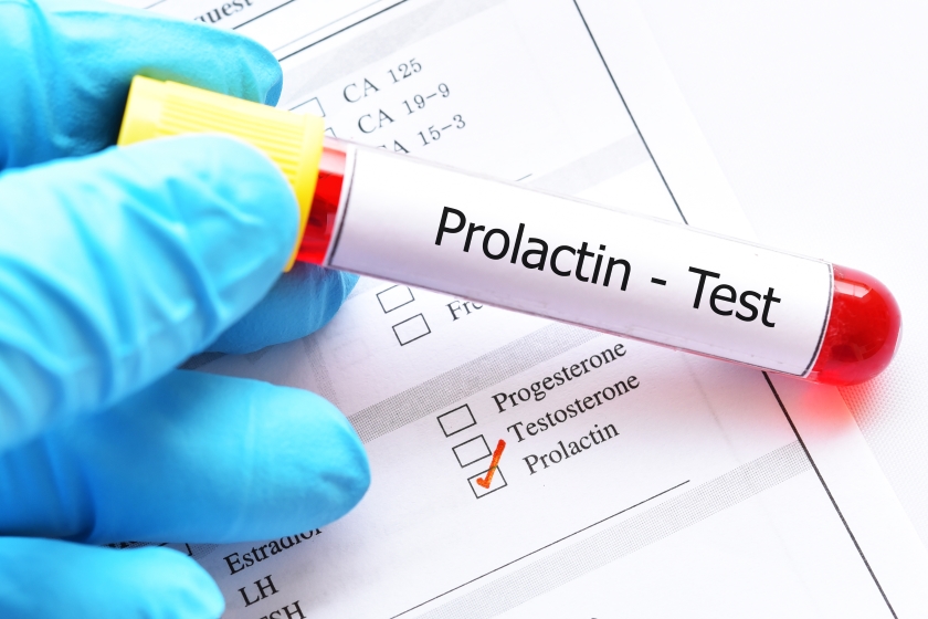 Informatii despre prolactina