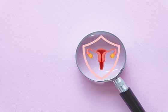 Ovare polichistice: cauze, simptome si solutii