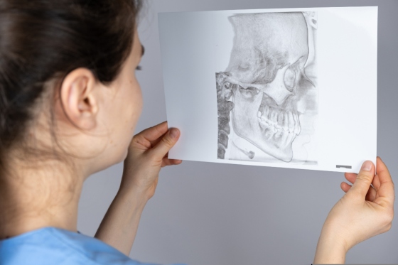 Articulatie temporo mandibulara: anatomie si functii