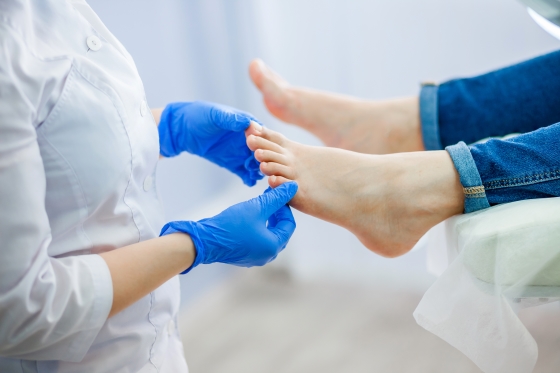 Ciuperca piciorului - cauze si optiuni de tratament