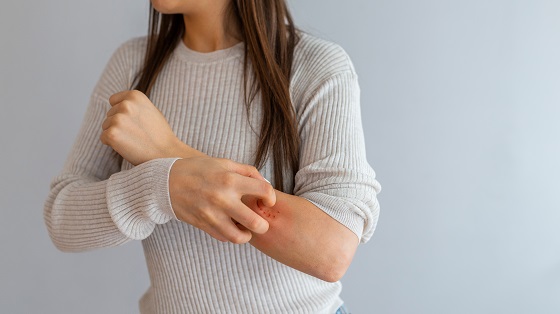 Pruritul sau mancarimea pielii – cauze, factori de risc si tratament