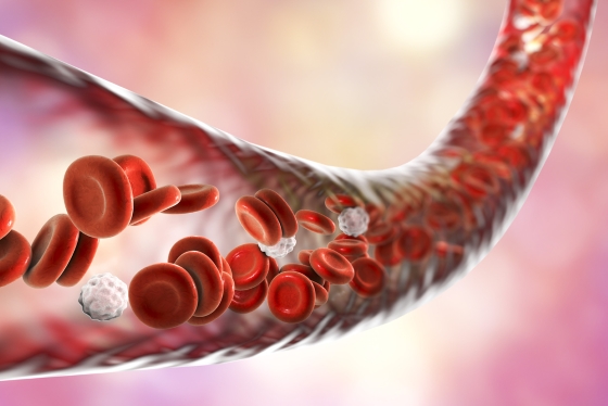Curatarea vaselor de sange – ce inseamna si care sunt alimentele care ajuta
