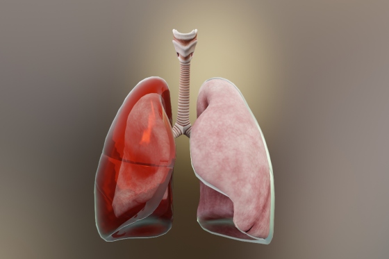 Hemotorax - simptome, diagnostic si tratament