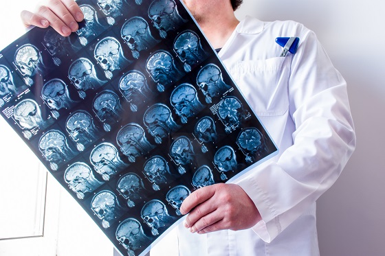 Sistem nervos periferic: anatomie, rol si functii