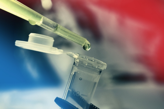 Spermocultura: ce este, cand este indicata si cum se realizeaza