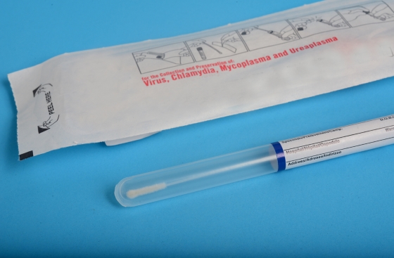 Infectia cu ureaplasma – transmitere, tablou clinic si tratament