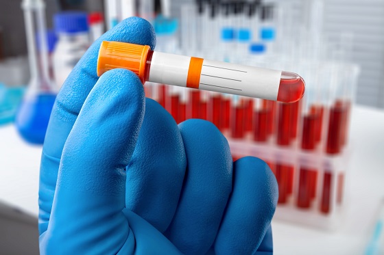 Hemoleucograma completa la copii: ce trebuie sa stie parintii?