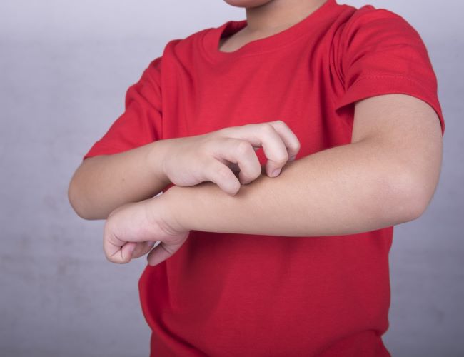 Dermatita atopica la copii - informatii de specialitate