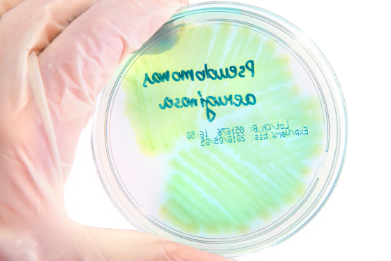 Infectia cu Pseudomonas aeruginosa