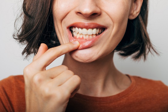 Retractie gingivala: cauze frecvente si solutii reale