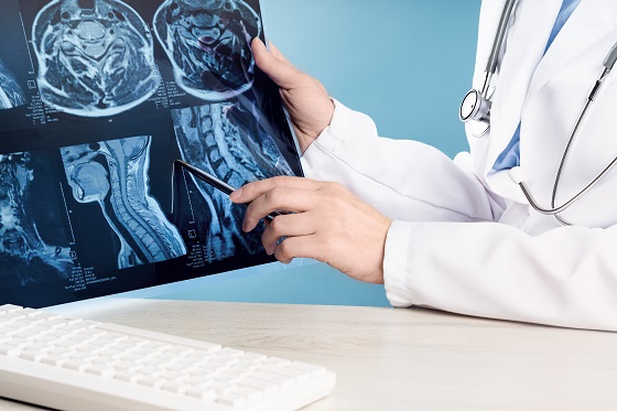 Encefalocel: cauze, simptome, diagnostic si tratament