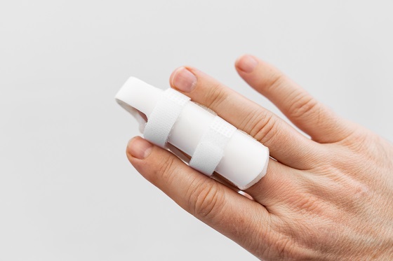 Fractura de falanga: simptome, diagnostic, tratament si recuperare