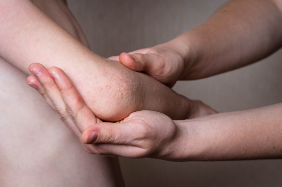 Flictene (basici pe piele): ce sunt, cauze, simptome, tratament, preventie si ingrijire