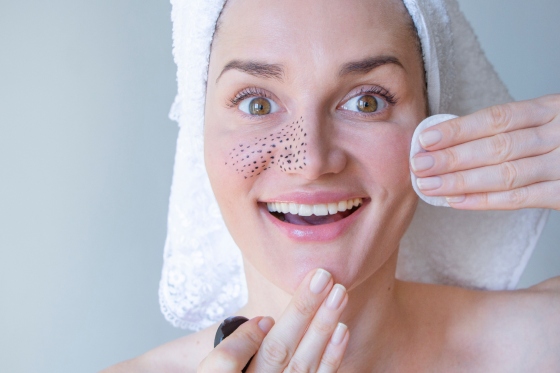 Filamente sebacee: ce sunt, cum arata si ce tratament exista