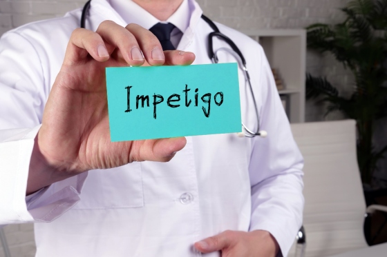 Impetigo – cauze si tratament