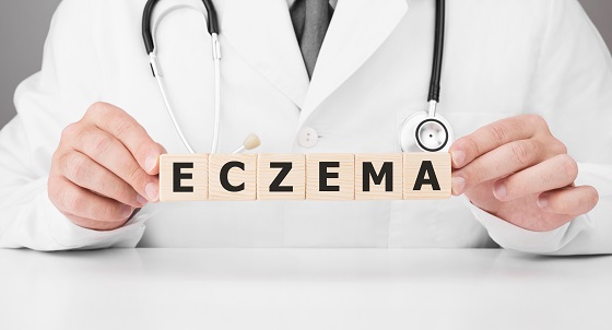 Eczema numulara – cauze, factori de risc, simptome si tratament 