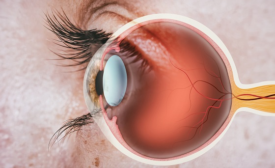 Lacrimarea ochilor – factori de risc, cauze si afectiuni asociate