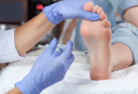 Picior cav sau picior scobit: simptome, diagnostic si solutii de tratament