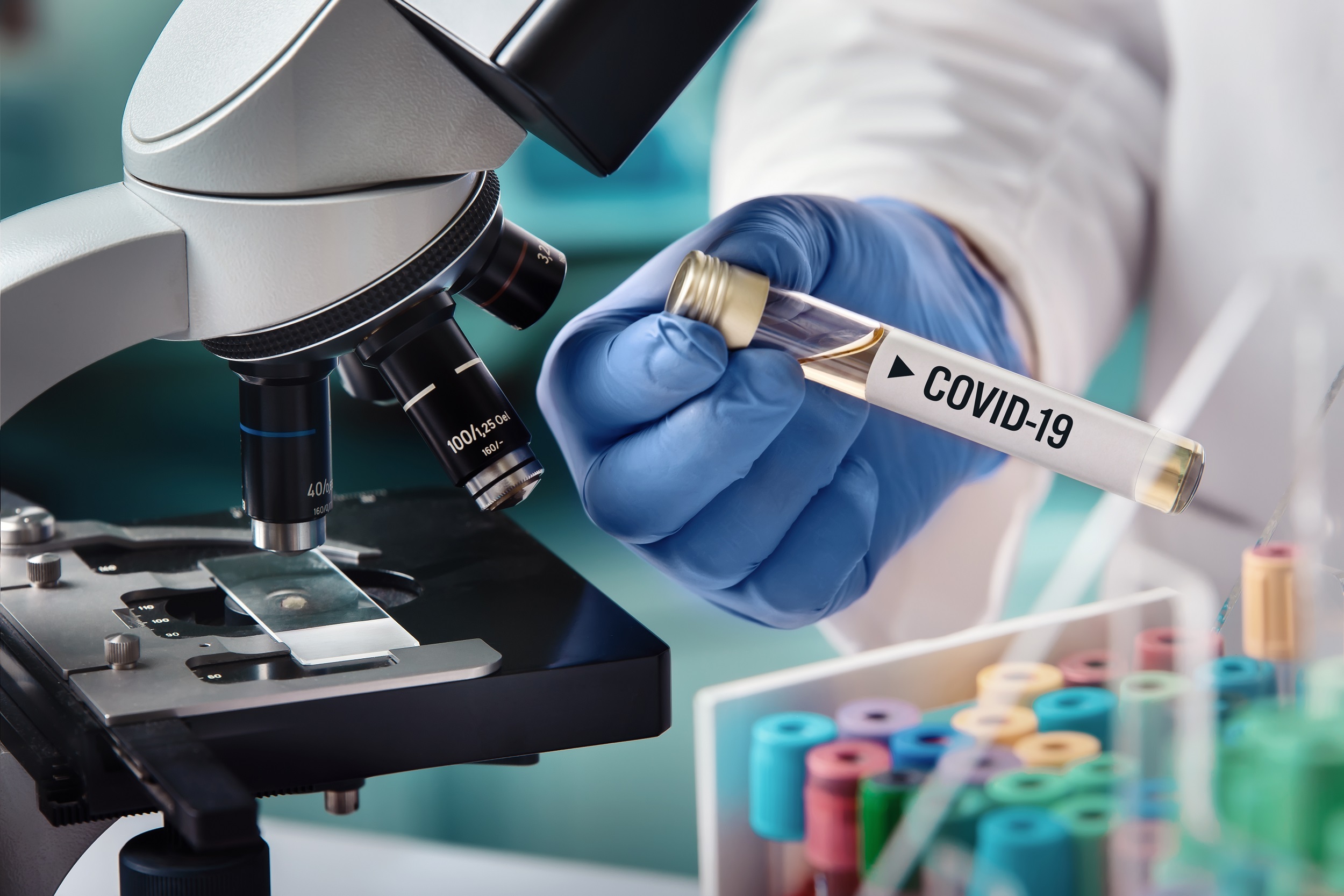 Medicii continua sa descopere noi moduri prin care coronavirusul ataca organismul uman 