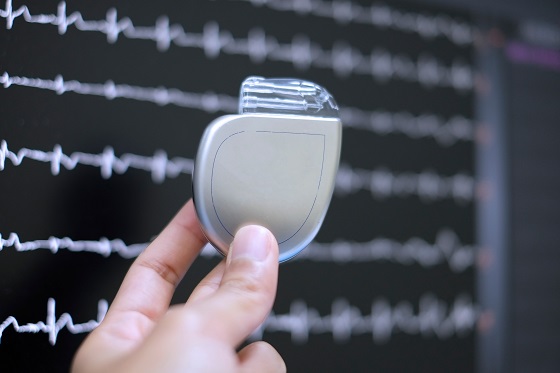 Informatii complete despre implantarea unui stimulator cardiac