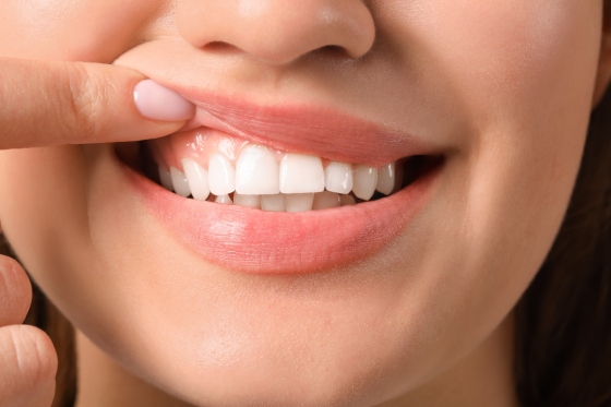 Beneficiile vitaminei C in mentinerea sanatatii gingiilor si dintilor