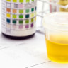 Examenul de urina si intelegerea lui: Corpi cetonici in urina