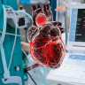 Anevrismul de aorta: simptome, diagnostic si tratament