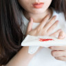 Tuse cu sange (hemoptizie) - cauze, afectiuni asociate, tratament