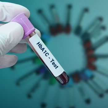 Ce este hemoglobina glicata (HbA1c) si de ce este mai importanta decat glicemia simpla?
