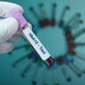 Ce este hemoglobina glicata (HbA1c) si de ce este mai importanta decat glicemia simpla?