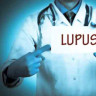 Care este lista de alimente interzise in lupus?