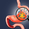 Test Helicobacter pylori: tipuri, interpretare si importanta