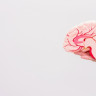 Sindromul cerebelos: cauze, diagnostic, manifestari clinice si tratament