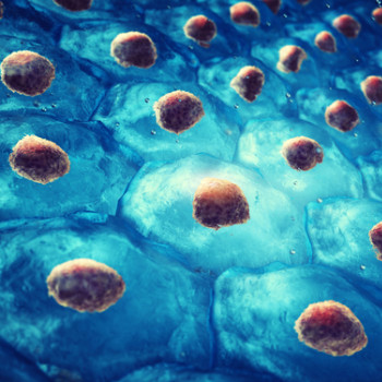 Sindromul Lyell: cauze, simptome, diagnostic si tratament