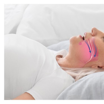 Sindromul de apnee in somn si legatura cu problemele ORL
