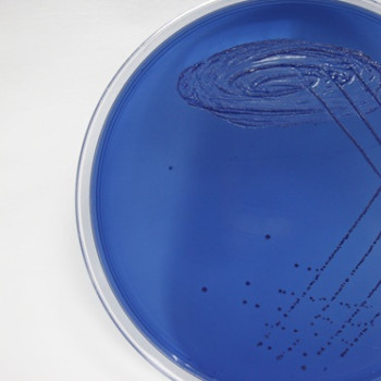 Streptococcus salivarius: ce reprezinta, ce rol joaca, mecanisme de actiune