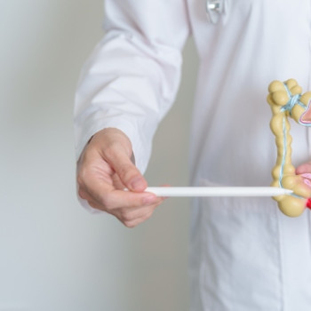 Sigmoidita: ce este, cauze si simptome principale ale inflamatiei colonului sigmoid