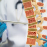 Totul despre calciu in osteoporoza: cat, cum si cand sa il administrati