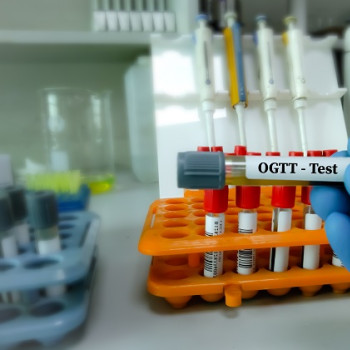 Testul de toleranta la glucoza (TTGO)