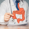 Colita colagenoasa: ce este, cum se manifesta, diagnostic si tratament