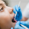 Micrognatie: ce este, pasi pentru diagnostic, plan de tratament, impact asupra calitatii vietii
