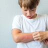 Probleme dermatologice care ii pot afecta pe copii vara: simptome si tratamente