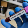 Infectia cu streptococ. Simptome streptococ in gat