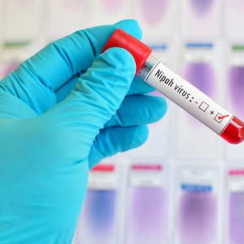 Virusul Nipah: cum se transmite, simptome si masuri de preventie