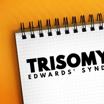 Trisomie 18 (sindrom Edwards)