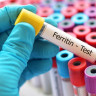 Feritina scazuta: cauze, afectiuni, recomandari medicale