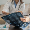 Boala Tay-Sachs – ce este, simptome, diagnostic si tratament